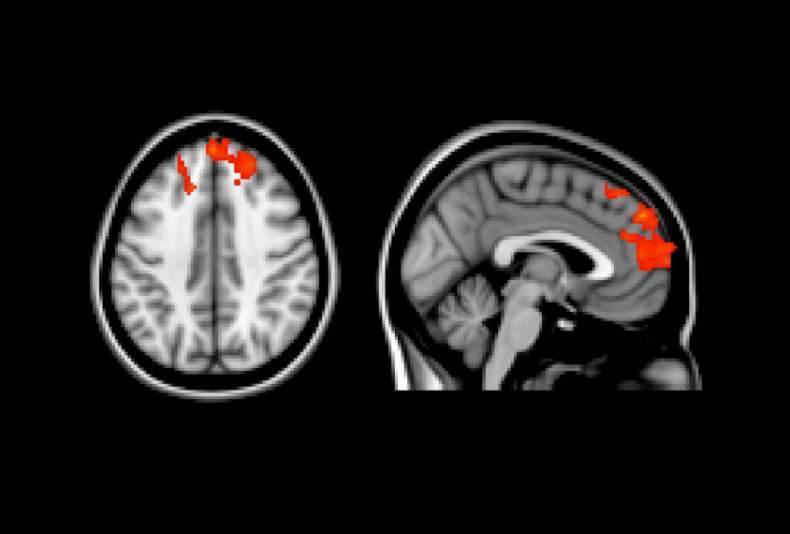 Communication in brain 1