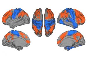 Autism brains